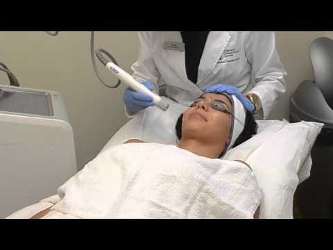 Cutera Laser Genesis & Excel V