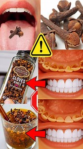 3.7K views · 34 reactions | Discover a simple home remedy using baking powder, clove, and Colgate toothpaste to help clean and refresh your teeth naturally. This mixture is often used for reducing surface stains and improving oral freshness. However, baking powder can be abrasive, so use this method carefully and only occasionally to avoid damaging your enamel. For long-term dental care, regular brushing and professional check-ups are always recommended. | Health Zone | Facebook