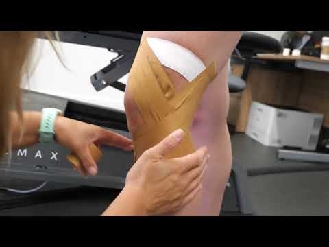 Knee LCL Strapping Technique | South Coast Rx Physiotherapy