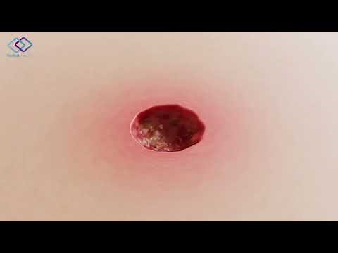 AQUACEL Foam Perfect Partners