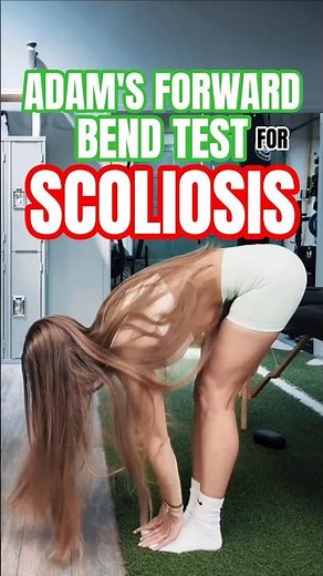 Use the ADAM'S FORWARD BEND TEST to Assess Scoliosis | Special Orthopedic Test for Scoliosis