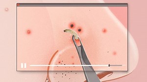 When Your Skin Condition Becomes Viral Content