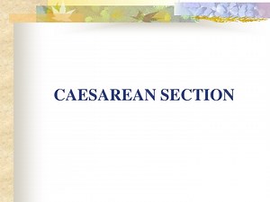 CAESAREAN SECTION - SlideServe