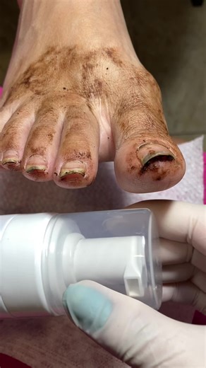 💁🏻‍♀️ Esse é o tipo de vídeo que divide opiniões… Mas todo mundo ama ver o resultado!❤️Você também sentiu o prazer em ver uma limpeza completa dessa?🧱Do barro ao brilho! ✨Esmaltes usados: 1. Lua da Impala 2. Lenda da Drika 3. França da Colorama✨ 🏃‍♀️ Garanta já o meu eBook completo para iniciantes!Com técnicas, segredos e passo a passo pra você crescer na área. Clique no link da bio!💖 #asmr #asmrnails #asmrsatisfying #unhadospes