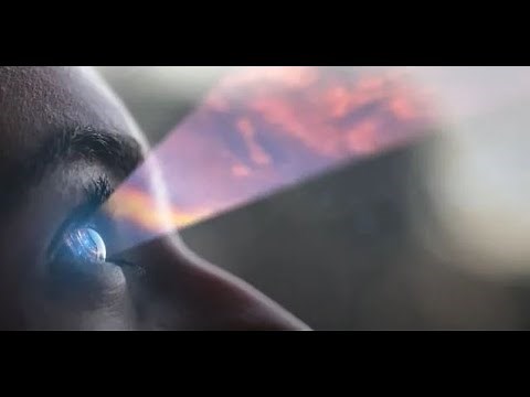 What’s next in CT for Canon Medical?