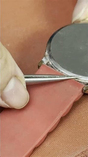 watch repair today 10