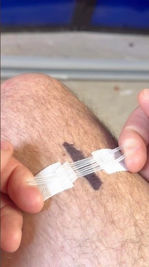 Zip Stitch #survival