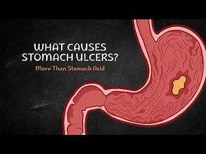 Stomach Ulcers Explained | Causes, Symptoms & Treatment