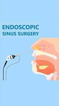 Balloon Sinuplasty vs. Endoscopic Sinus Surgery: What’s the Difference?