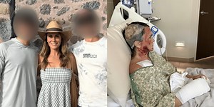 Savannah Police give Sunday update on acid attack investigation at Forsyth Park