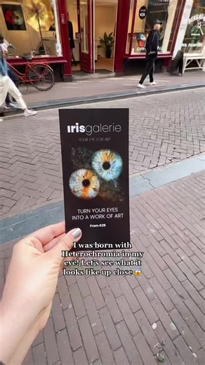 Stunning Eye Photography with Heterochromia