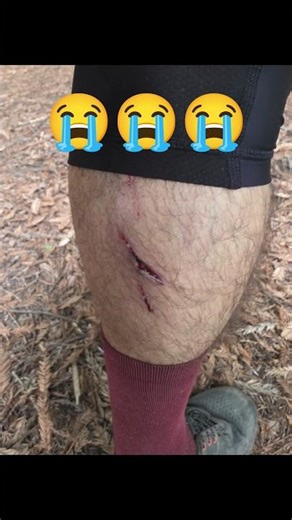 OUCH!! Pedal cut into my calf on this jump trail