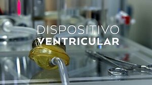 Dispositivo Ventricular