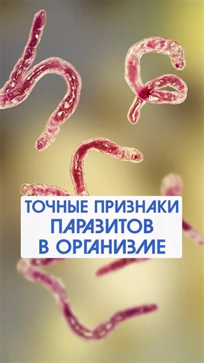 What are the actual symptoms of parasites? #vasilykorolishin #health #parasites