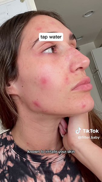 Replying to @Karma Kelly Small but mighty. Your skin deserves the high quality water at a minimum. #skincare #skincarehacks #waterfilter