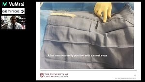 The Intra-Aortic Balloon Pump The Ins and Outs of IAB Insertion and Access Management