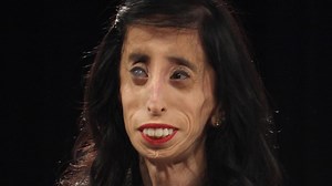 Cruel trolls labelled Lizzie Velasquez the 'world's ugliest woman' - but what is lipodystrophy, and how does it age you?