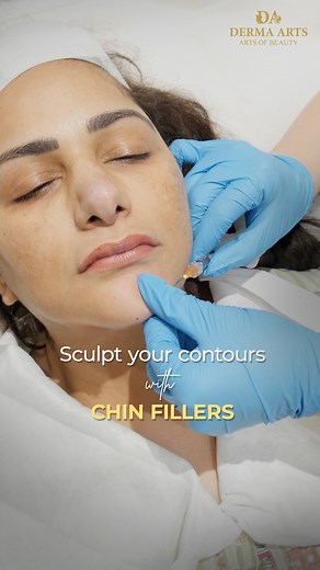 Chin filler, also known as chin enhancement, is a cosmetic procedure...