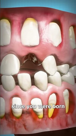 How Adult Teeth Grow In 🤔