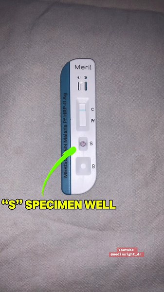 Rapid Diagnostic Test for Malaria Explained