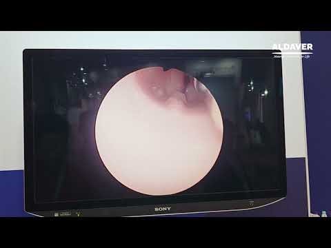 BPH Training Model Compatible with Various Devices | Realistic Urology Simulation