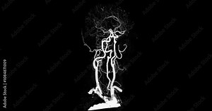 Dynamic CTA brain scan showcasing detailed vascular structures, highlighting blood flow and arterial formations for medical diagnostics and research.