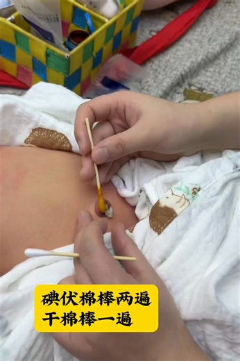 New born diaries 6 on Instagram: "Newborn Umbilical Cord Care: Don't Panic! 👶✨ Description Cleaning the umbilical cord for the first time can be scary, but it's so important for your baby's health! Watch the step-by-step process of gentle cleaning to keep the area dry and infection-free. Key Steps Shown: Use a cotton swab with povidone-iodine to gently clean around the base. Repeat with a clean swab to ensure thoroughness. Finish with a dry cotton swab to keep the area moisture-free. Remember,