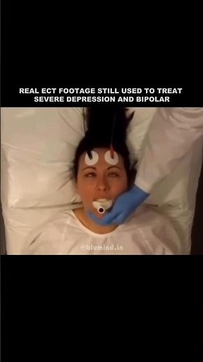 How ECT Looks in Real Medical Practice