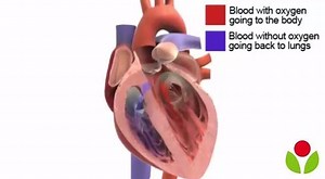 How heart valve replacement surgery is performed? | Lazoi