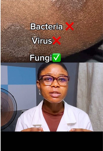5 Mistakes to Avoid for Fungal Skin Infections