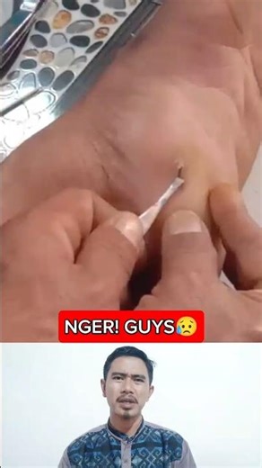 REMOVE THE SPINS IN THE MEAT ||494 #fyp #short #shorts #feedshorts #trending #viral #splinter