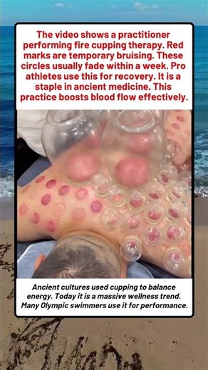 Exploring The Ancient Art Of Fire Cupping Therapy
