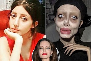 Who is Sahar Tabar and what did the Angelina Jolie fan look like before surgery?