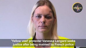 This is Vanessa Langard, she was hit in the face by a rubber bullet fired by police during a protest on Dec 15, 2018. She has since lost the use of her left eye and says her face was completely deformed after the incident as you can see. This is what is going on in the EU under Macron, will Vanessa be featured on the BBC? Show people the reality of the horrors of life in the EU! | UNN