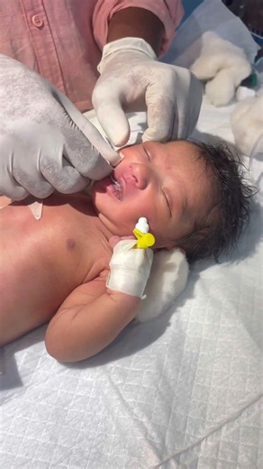 putting ogtu on newborn baby😭😭 #youtubeshorts #nursing #medical #newbornbaby #cutebaby #childbirth