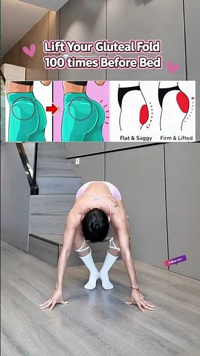100 Reps Before Bed to Lift Your Gluteal Fold and Turn Flat & Saggy into Firm & Round! 🍑