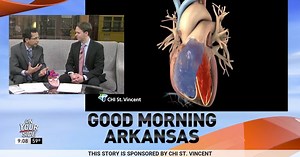 24K views · 312 reactions | Approximately 33.5 million people around the world have an arrhythmia called Atrial Fibrillation or AFib. Untreated, AFib can lead to serious complications like stroke and heart failure. That’s why it’s critical that you seek help as soon as you start experiencing symptoms. | KATV Channel 7 | Facebook
