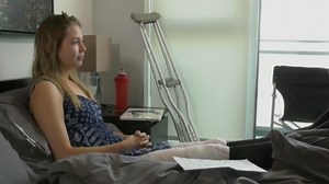 Model burned over 25 percent of body after catching on fire in photo shoot gone wrong