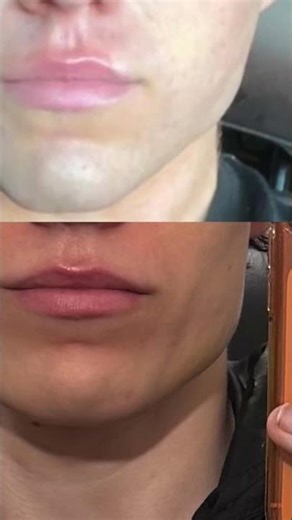 "Your face change was from fat loss" 😭