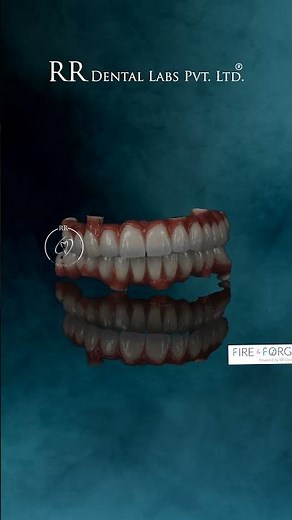 Its RR Dental lab- best dental lab in India