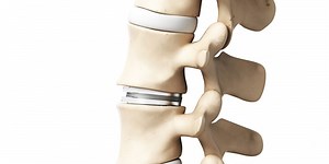 How to strengthen your bones