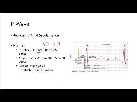 ECG 3: Segments, Waves and Intervals