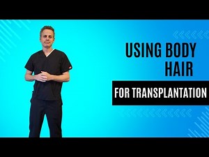 All about Body Hair Transplantation (BHT)