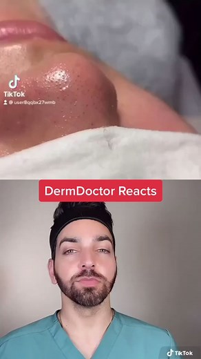 Sebaceous Filaments Solution #dermdoctor #dermatologist #pimplepopping #reactionvids #learnontiktok #tiktokpartner
