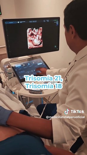 Test Prenatal No Invasivo UNITY: Salud para tu Bebé