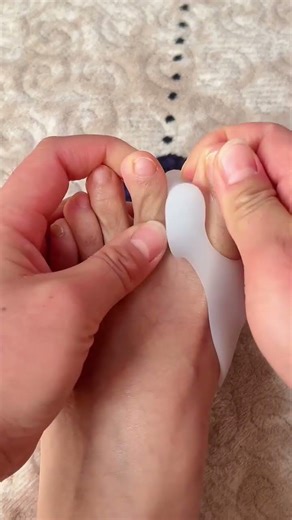 Perfect Toe Alignment Hack | Easy Foot Care Trick for Comfort & Relief