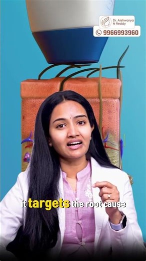 Laser Hair Reduction Treatment | Safe, Effective Results at Casaderma | Dr Aishwarya Reddy