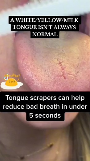 How to Clean Your Tongue and Remove Bacteria and Dirt | Tongue Scraper Tips