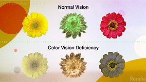 Color Blindness - Causes And Diagnosis | Fort Lauderdale Eye Institute