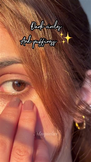Say Goodbye to Dark Circles with This Eye Serum
